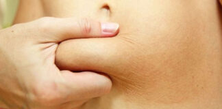 Medycyna estetyczna: zabieg liposukcji